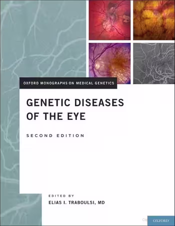 خرید و دانلود نسخه کامل کتاب Genetic Diseases of the Eye