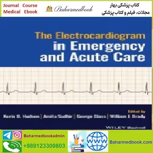 The Electrocardiogram in Emergency and Acute