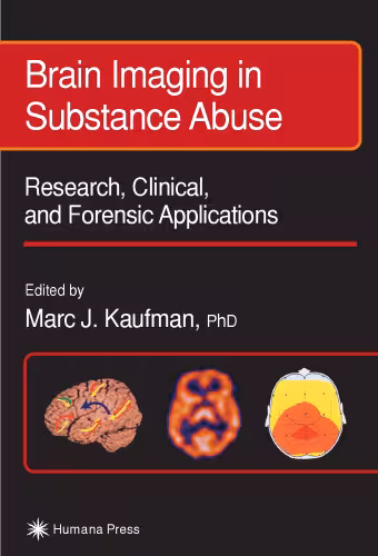خرید و دانلود نسخه کامل کتاب Brain Imaging in Substance Abuse. Research, Clinical and Forensic Applns