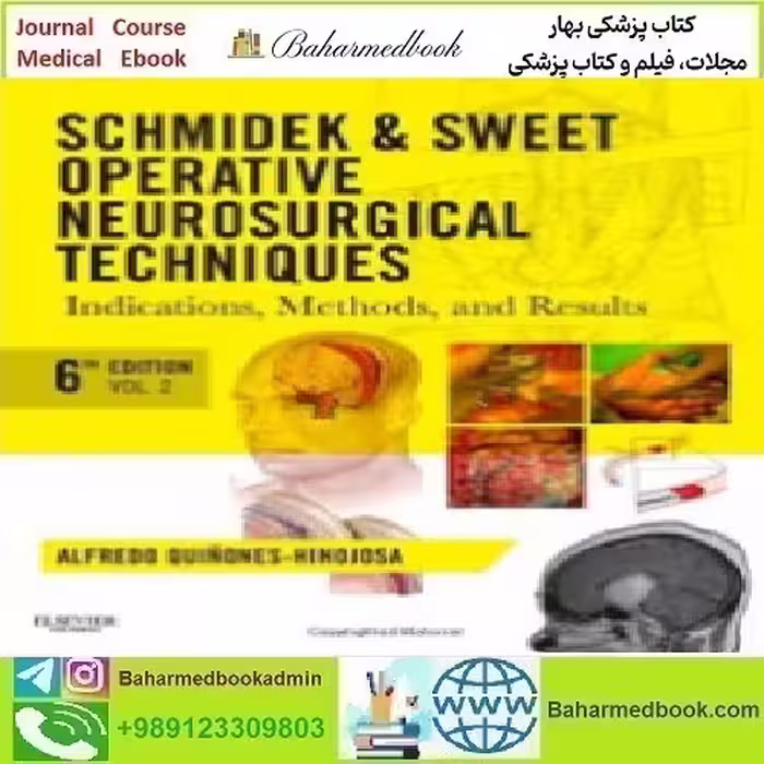 Schmidek and Sweet Operative Neurosurgical Techniques 2 Vol