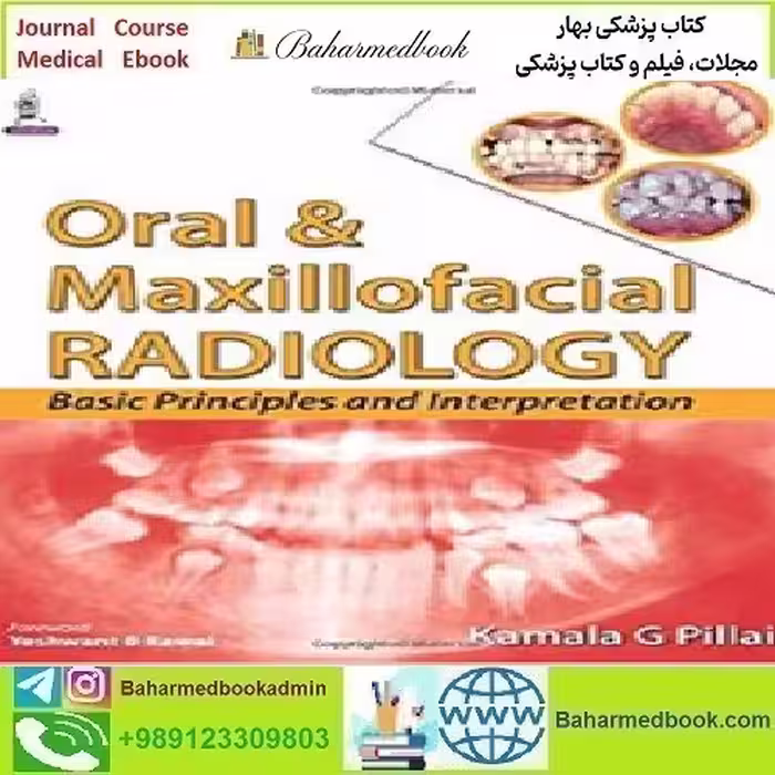 Oral and Maxillofacial Radiology Basic Principles and Interpretati