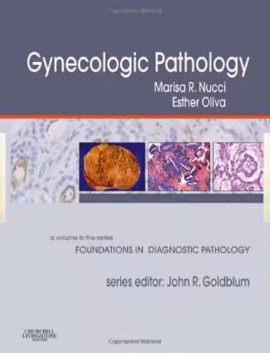 خرید و دانلود نسخه کامل کتاب Gynecologic Pathology (Foundations in Diagnostic Pathology Series)