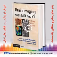 Brain Imaging with MRI and CT: An Image Pattern Approach
