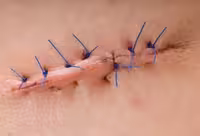 Incision Care 2019 Surgery_Course_Videos - کتاب پزشکی بهار