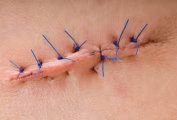 Incision Care 2019 Surgery_Course_Videos - کتاب پزشکی بهار
