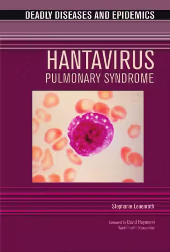 خرید و دانلود نسخه کامل کتاب Hantavirus Pulmonary Syndrome (Deadly Diseases and Epidemics)