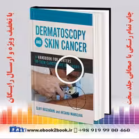 Dermatoscopy and Skin Cancer: A handbook for hunters of skin cancer and melanoma