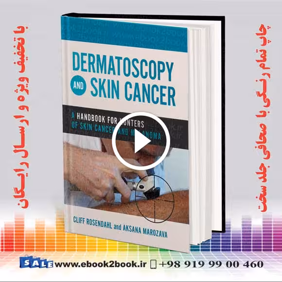 Dermatoscopy and Skin Cancer: A handbook for hunters of skin cancer and melanoma
