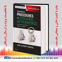 Tachdjian’s Procedures in Pediatric Orthopaedics