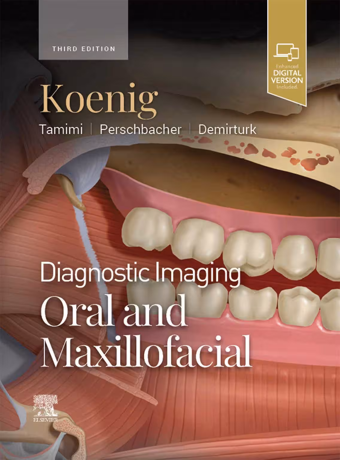 کتاب DIAGNOSTIC IMAGING: ORAL AND MAXILLOFACIAL – Koenig 2024 (THIRD EDITION) 2VOL