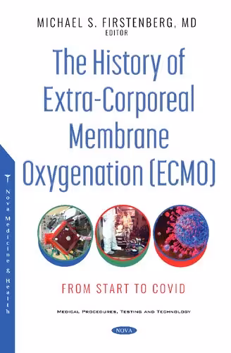 خرید و دانلود نسخه کامل کتاب The History of Extra-corporeal Membrane Oxygenation (ECMO): From Start to COVID