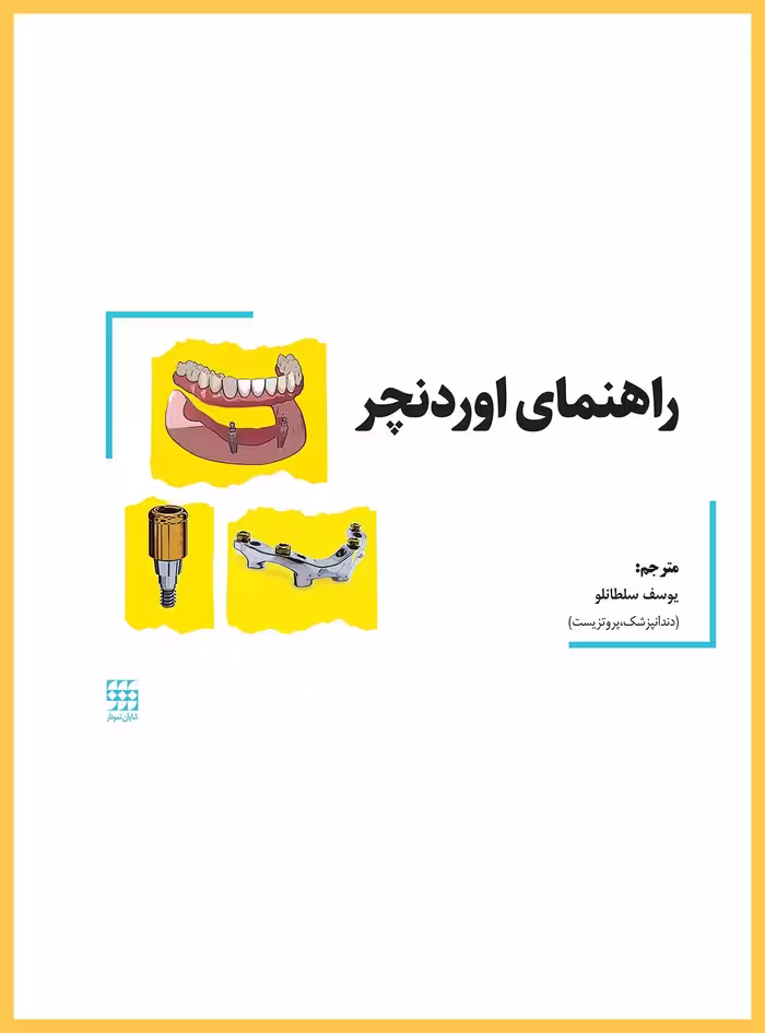 راهنمای اوردنچر