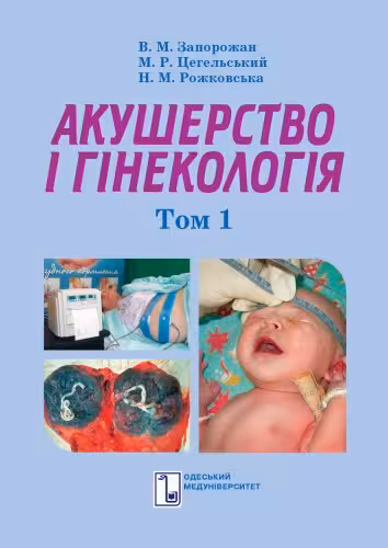 خرید و دانلود نسخه کامل کتاب Акушерство і гінекологія. Підручник. У 2-х томах