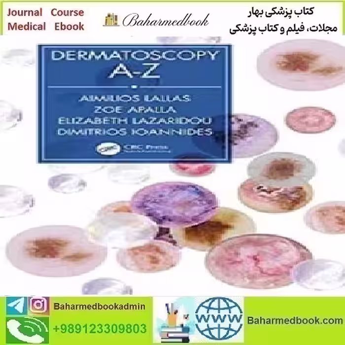 Dermatoscopy A Z 2020 TRUE PDF price 1€ - کتاب پزشکی بهار