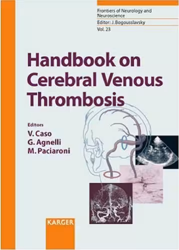 خرید و دانلود نسخه کامل کتاب Handbook on Cerebral Venous Thrombosis (Frontiers of Neurology and Neuroscience)