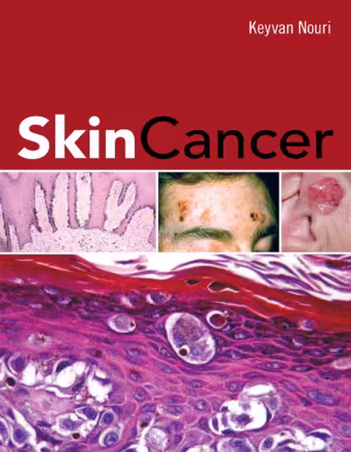 خرید و دانلود نسخه کامل کتاب Skin Cancer