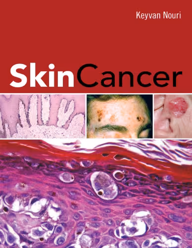 خرید و دانلود نسخه کامل کتاب Skin Cancer