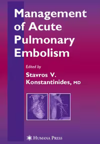 خرید و دانلود نسخه کامل کتاب Management of Acute Pulmonary Embolism (Contemporary Cardiology)
