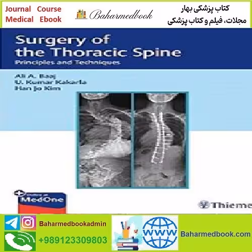 Surgery of the Thoracic Spine Principles and Techniques TRUE
