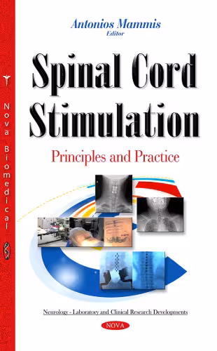 خرید و دانلود نسخه کامل کتاب Spinal Cord Stimulation