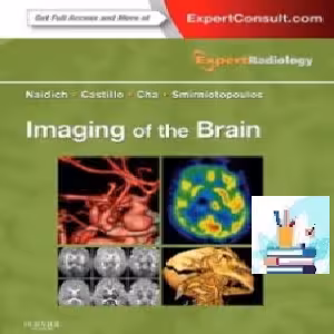 Imaging of the Brain TRUE PDF price 1€