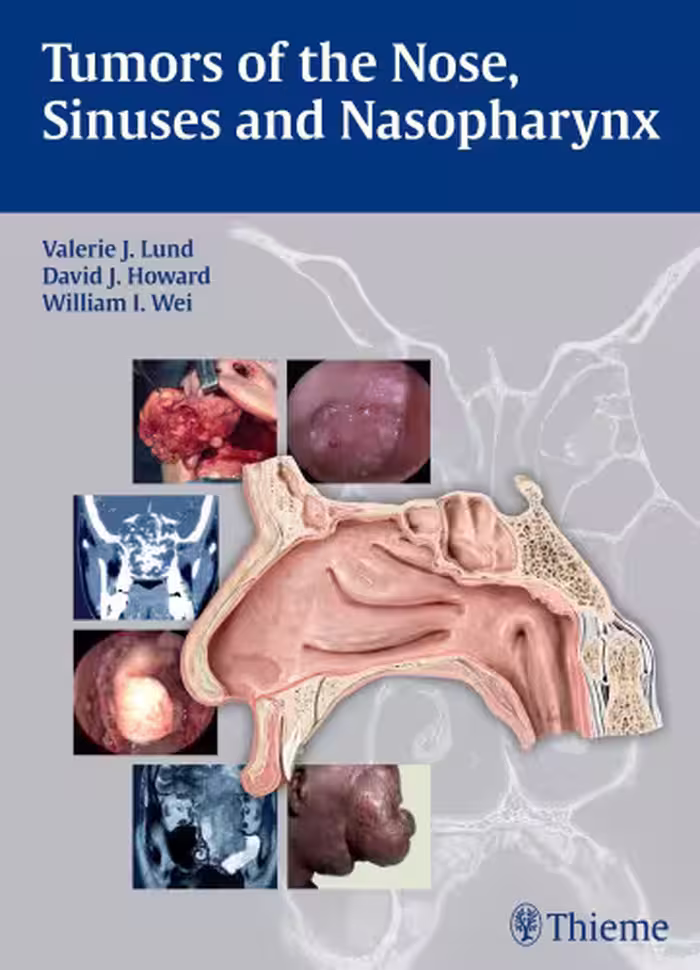 خرید و دانلود نسخه کامل کتاب Tumors of the Nose, Sinuses and Nasopharynx