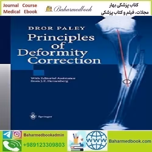 Principles of Deformity Correction 2014 TRUE PDF price 1€ - کتاب پزشکی بهار