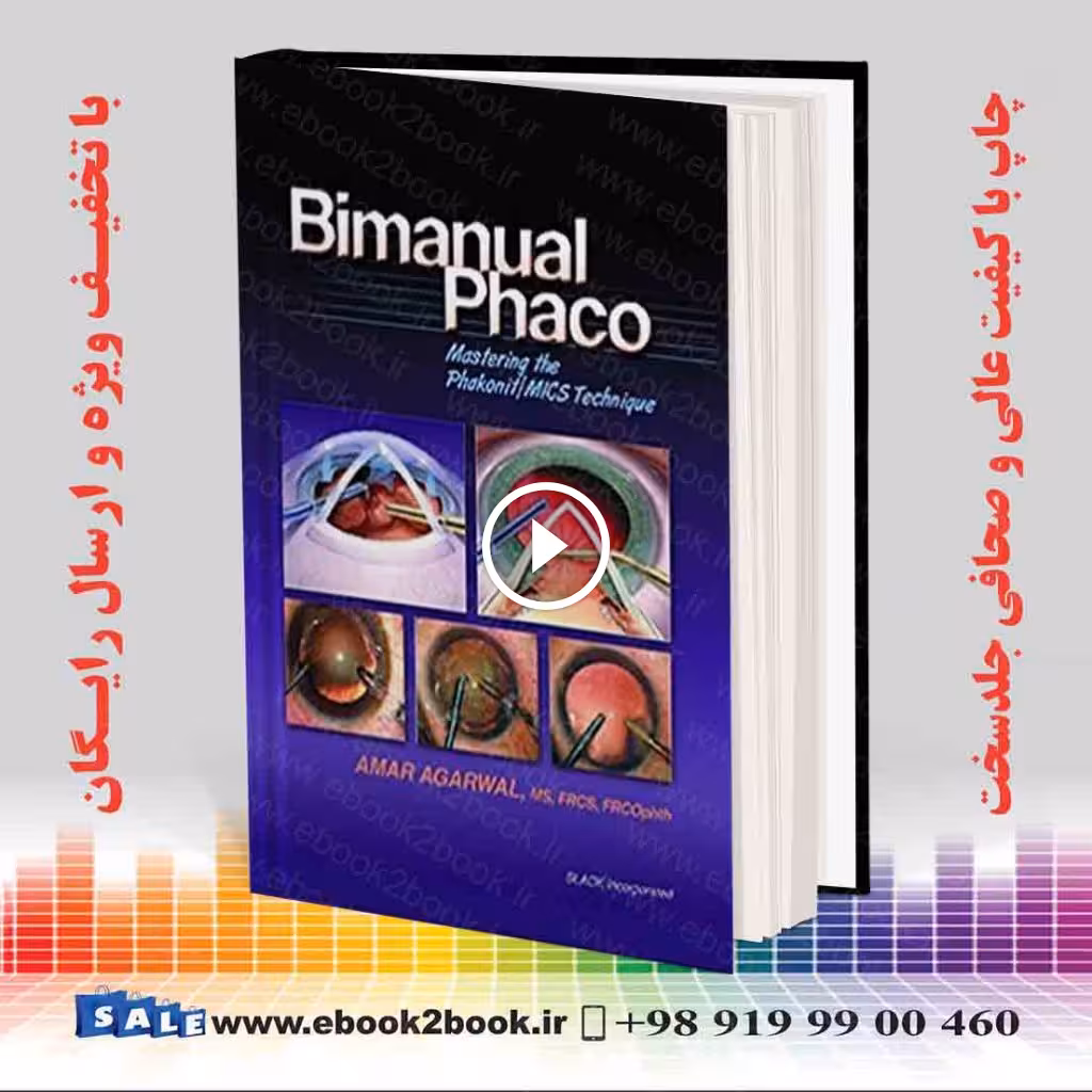 Bimanual Phaco: Mastering the Phakonit/MICS Technique