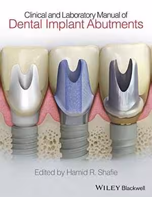 [PDF] دانلود کتاب Clinical And Laboratory Manual Of Dental Implant Abutments, 2014