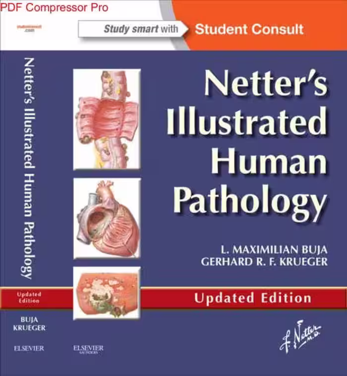خرید و دانلود نسخه کامل کتاب Netter's Illustrated Human Pathology