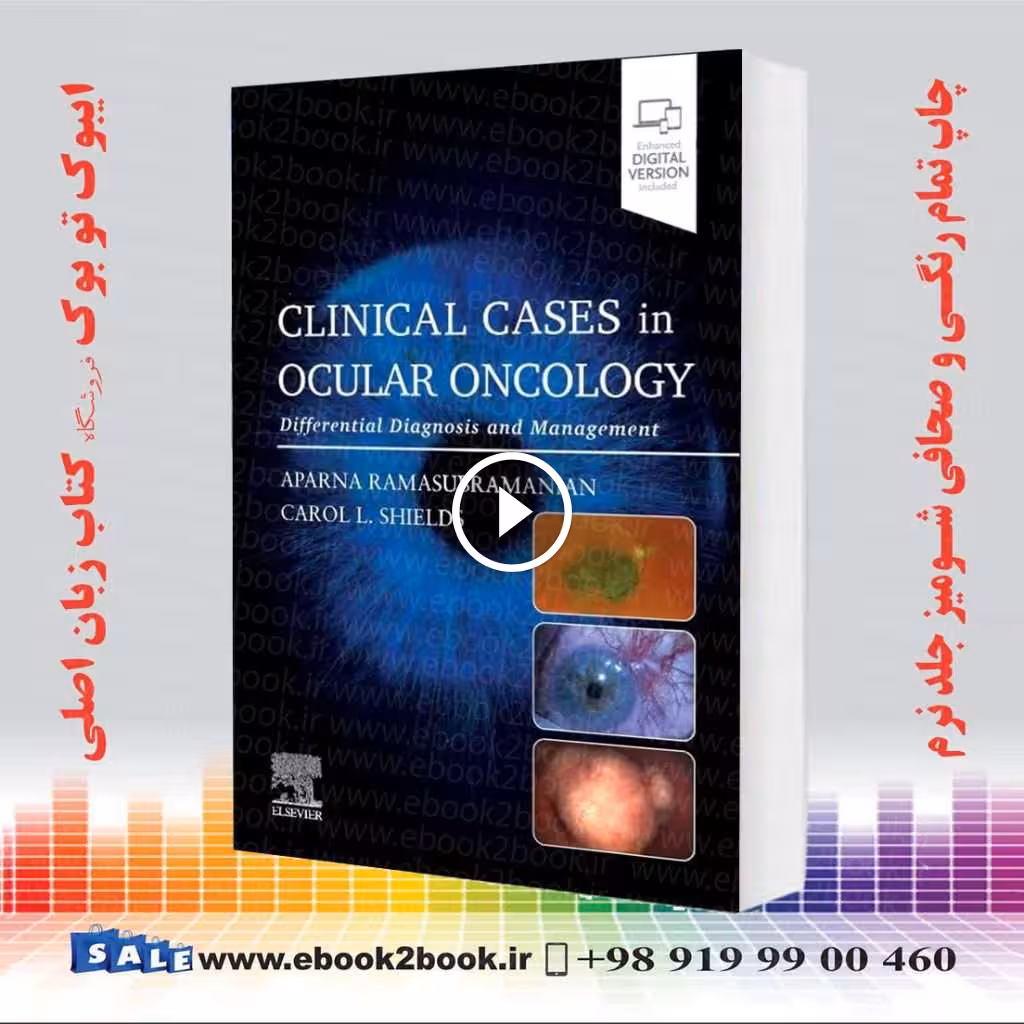 Clinical Cases in Ocular Oncology