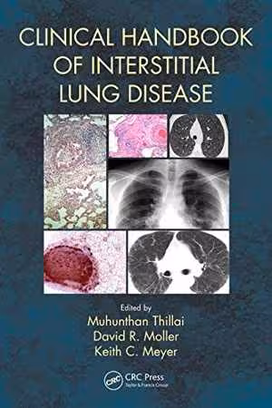 [PDF] دانلود کتاب Clinical Handbook Of Interstitial Lung Disease, 2018