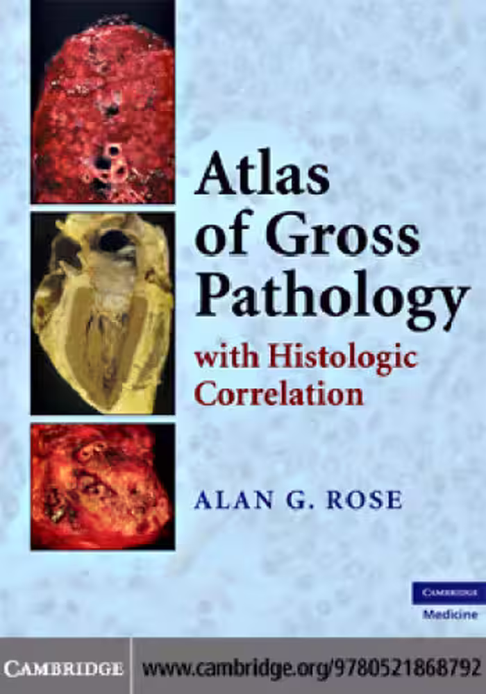 خرید و دانلود نسخه کامل کتاب Atlas of Gross Pathology: With Histologic Correlation