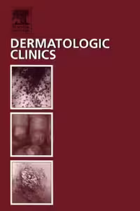 خرید و دانلود نسخه کامل کتاب Dermatologic Clinics (Infectious Diseases, Volume 21, Number 2, April 2003)