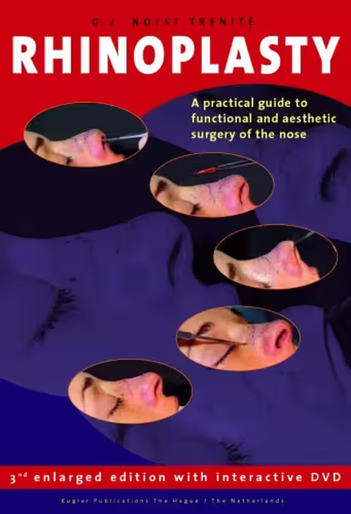 خرید و دانلود نسخه کامل کتاب Rhinoplasty: A practical guide to functional and aesthetic surgery of the nose, 3rd Edition