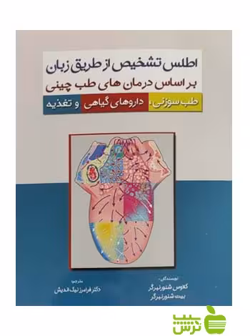 اطلس تشخیص از طریق زبان اشراقیه - سیب ترش - SibTorsh خرید با تخفیف ویژه