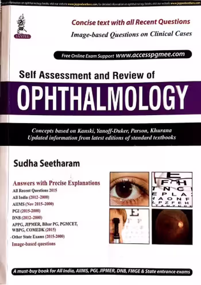 خرید و دانلود نسخه کامل کتاب Self assessment and review of ophthalmology
