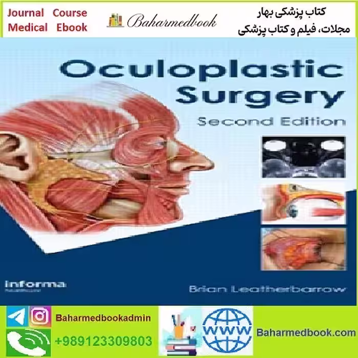 Oculoplastic Surgery TRUE PDF price 1€ - کتاب پزشکی بهار