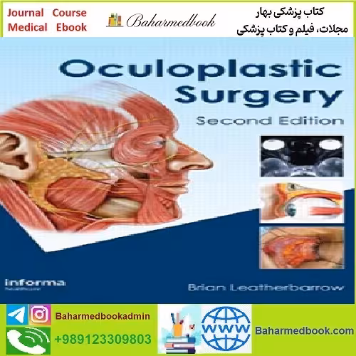 Oculoplastic Surgery TRUE PDF price 1€ - کتاب پزشکی بهار