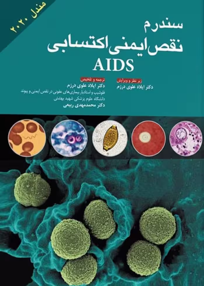 سندرم نقص ایمنی اکتسابی AIDS مندل 2020