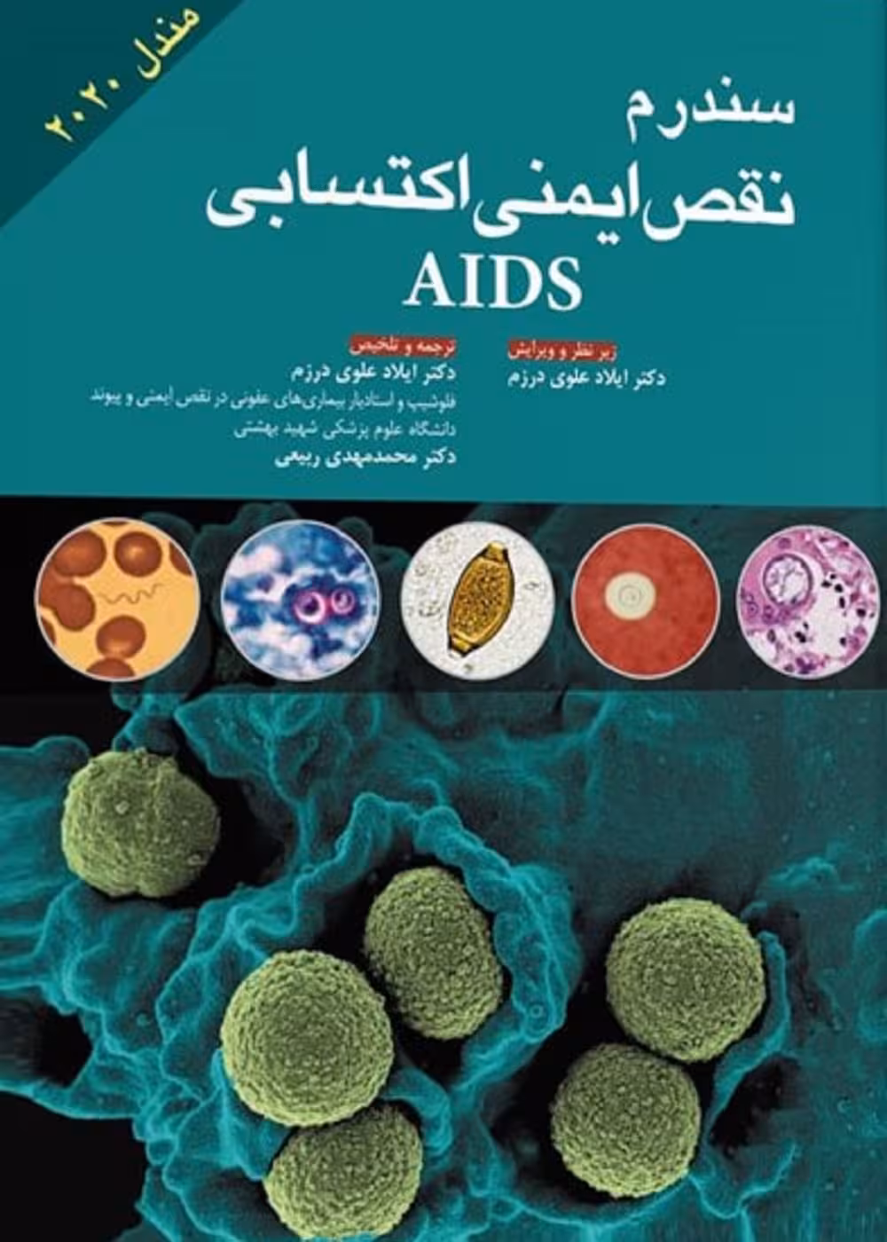 سندرم نقص ایمنی اکتسابی AIDS مندل 2020