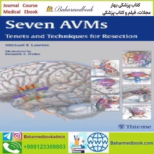 Seven AVMs Tenets and Techniques for Resection TRUE