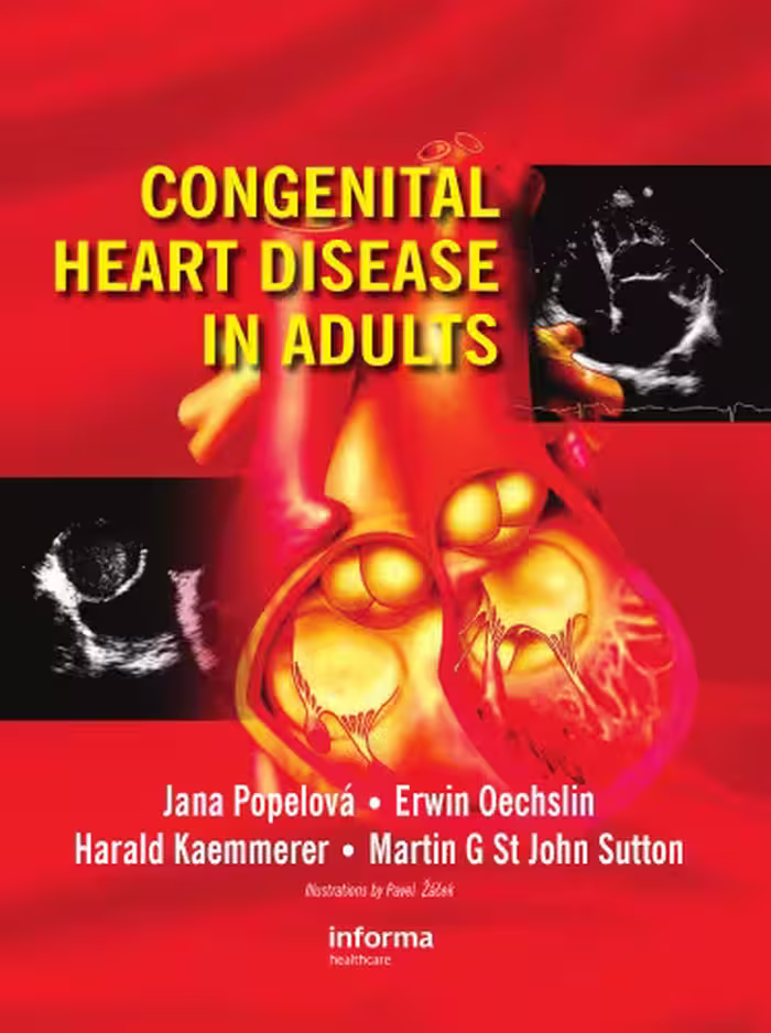 خرید و دانلود نسخه کامل کتاب Congenital Heart Disease in Adults