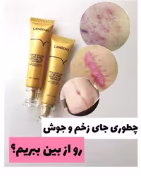 کرم ترمیم کننده لانبنا با لیبل اصلی