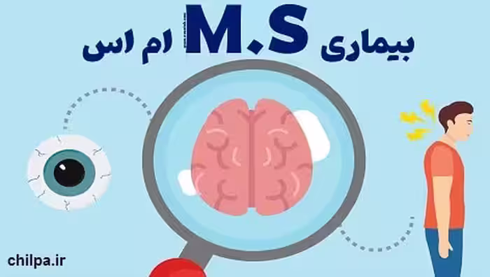 پاورپوینت درباره بیماری MS با 53 اسلاید - چیلپا