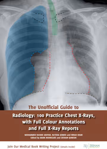 خرید و دانلود نسخه کامل کتاب The Unofficial Guide to Radiology