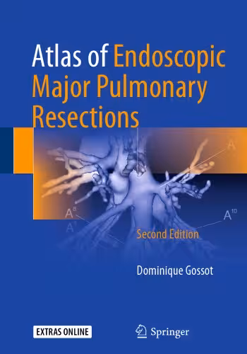 خرید و دانلود نسخه کامل کتاب Atlas of Endoscopic Major Pulmonary Resections