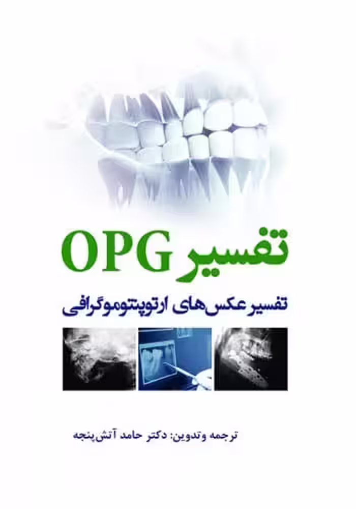 تفسیر OPG تفسیر عکس‌های ارتوپنتوموگرافی
