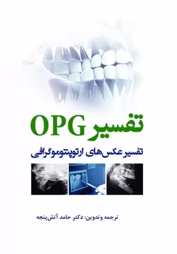 تفسیر OPG تفسیر عکس‌های ارتوپنتوموگرافی