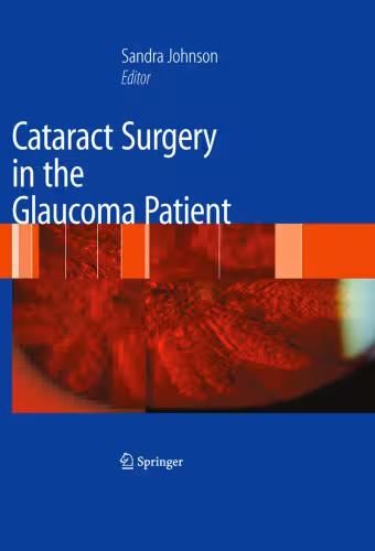 خرید و دانلود نسخه کامل کتاب Cataract Surgery in the Glaucoma Patient